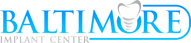 baltimore-implant-center-dental-implants-maryland